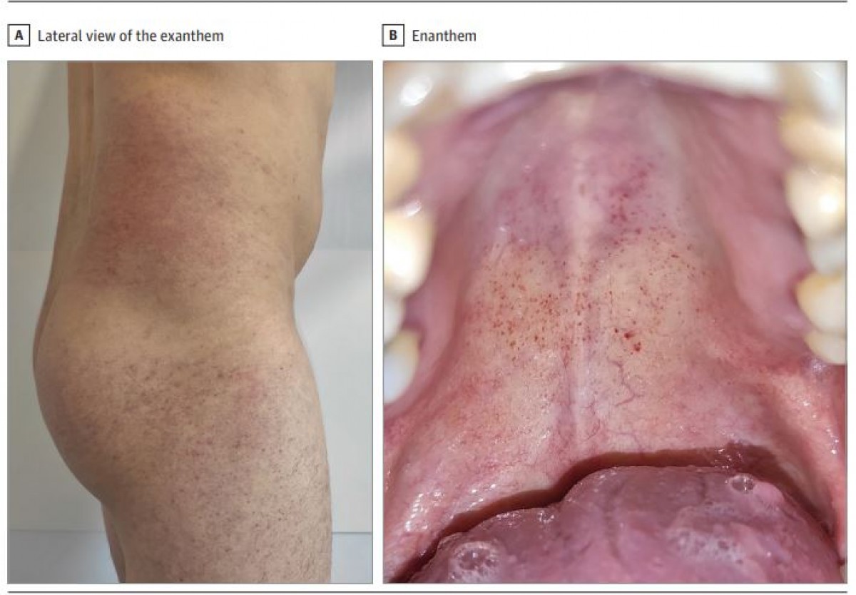 Imágenes del estudio en JAMA Dermatology, Imágenes del estudio en JAMA Dermatology,